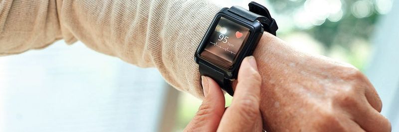 Smartwatches sind deutlich günstiger als Langzeit-EKG-Geräte