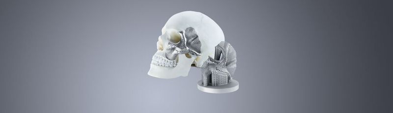 Der russische Medizintechnikhersteller Conmet stellt mit einem 3D-Drucker von Trumpf bereits seit Anfang 2018 patientenspezifische Gesichts- und Kieferimplantate her.