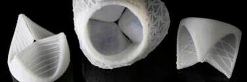 Die Klappenflügel (links und rechts) werden gezielt mit Silikonfäden verstärkt. Das gesamte Implantant umfasst zudem auch die Aortenwurzel (Mitte).