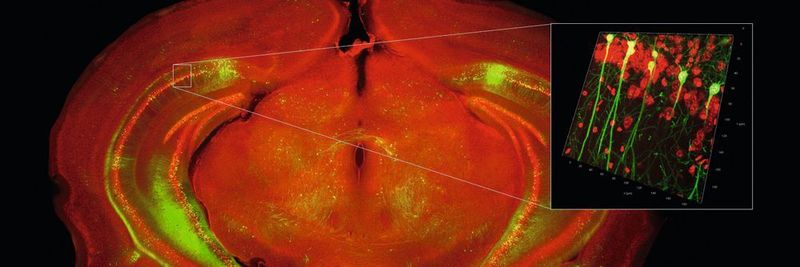 Abb. 1: Übersicht über den mit einem automatisierten Weitfeldmikroskop aufgenommenen Gehirnschnitt der Maus und 3D-Rendering einer Region im Hippocampus (Zellkerne in rot. Hippocampale Neuronen in grün).