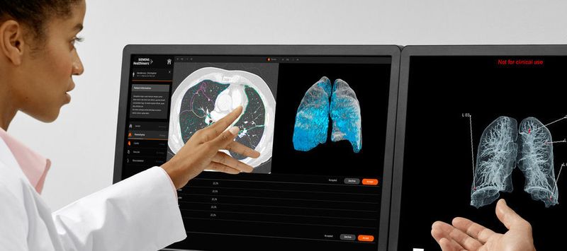AI-Rad Companion Chest CT ist eine auf künstlicher Intelligenz (KI) basierende Software für die Computertomografie (CT). Die zugrundeliegenden Algorithmen wurden in Wissenschaftsteams bei Siemens Healthineers anhand von umfangreichen klinischen Datensätzen trainiert.