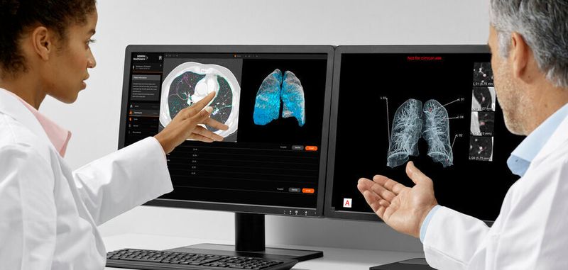 AI-Rad Companion Chest CT ist eine auf künstlicher Intelligenz (KI) basierende Software für die Computertomografie (CT). Die zugrundeliegenden Algorithmen wurden in Wissenschaftsteams bei Siemens Healthineers anhand von umfangreichen klinischen Datensätzen trainiert.