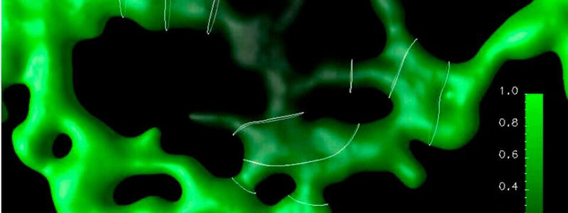 HPC-Simulation des Molekültransports in einer Zellorganelle, dem Endoplasmatischen Retikulum, dessen komplexe Geometrie die Transportprozesse bestimmt.