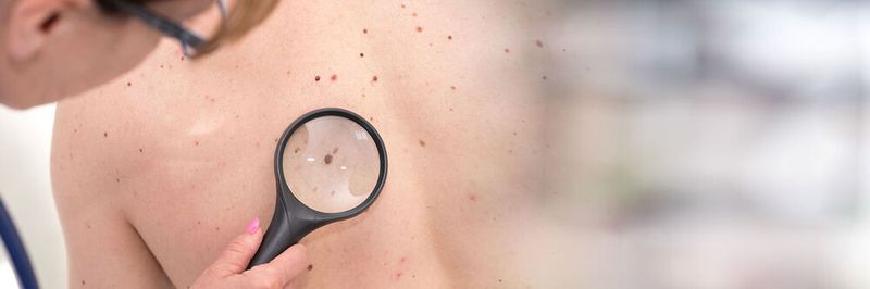 Allgemeinmediziner können Hauterkrankungen oft nicht richtig diagnostizieren. Ein Google-AI-Team forscht an einer Dermatologie-KI.