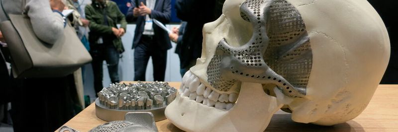 Schädelimplantate, Hüftgelenkpfannen und Zahnersatz, all das wird bereits in Serie auf Trumpf-Anlagen zur additiven Fertigung hergestellt.