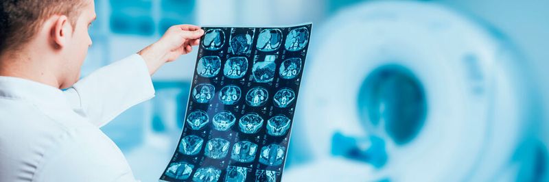 Rund 1,4 Millionen radiologische Bildaufnahmen, wie CTs, MRTs oder Mammographie-Bilder waren eine zeitlang offen über das Internet abrufbar.
