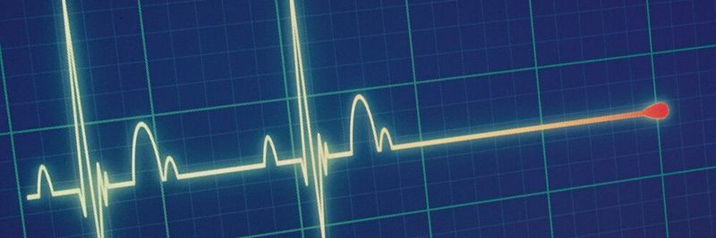 Mit Condition Monitoring und Predictive Maintenance lassen sich ungeplante Anlagenstillstände vermeiden.