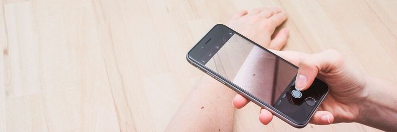 Mithilfe der App-Anwendung von OnlineDoctor können Patienten ihre Hautprobleme per Smartphone-Foto an ihren Hautarzt senden