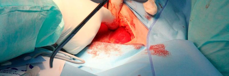 Sterilgüter wie OP-Bestecke werden in Krankenhäusern täglich gebraucht und sind ständig in einem Kreislauf aus Nutzung, Reinigung, Sterilisierung, Prüfung, Verteilung im Haus unterwegs.