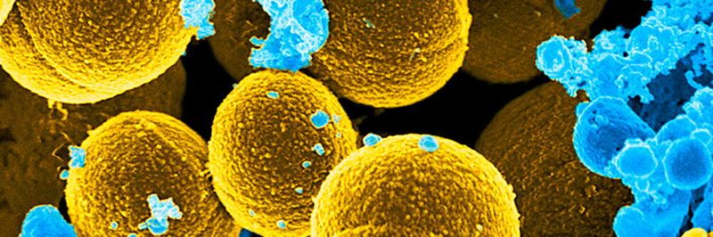 Bei Antibiotika-Resistenz gefährlich: Staphylococcus-aureus-Bakterien (rund/gelb) können u.a. Lungen-, Herz- und Hirnhautentzündung sowie Sepsis verursachen. Hier beim Versuch, weißen Blutkörperchen (blau) zu entkommen, die für die Infektabwehr zuständig sind