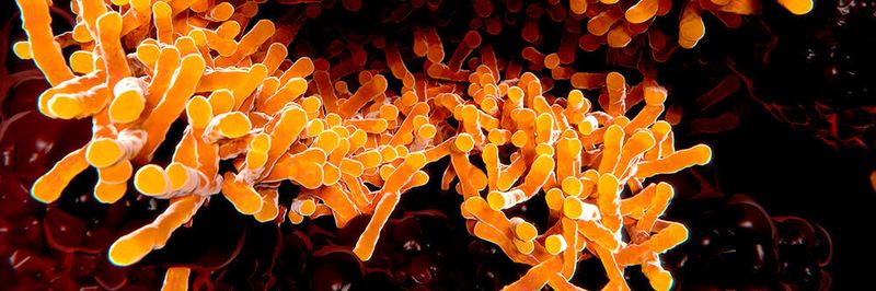 Abbildung: Tuberkulose Bakterien in der Lunge