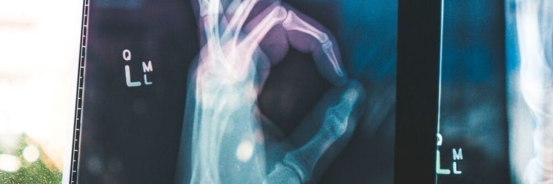 Additive Anwendungen verbereiten sich in der Medizinbranche immer weiter, weil sie einzigartige Vorteile mit sich bringen.