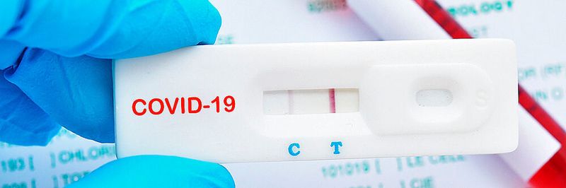 Schnell, sicher udnpreisgünstig soll der neue Coroan-Test sein