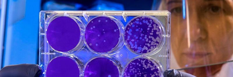 3DBio beschleunigt durch den Einsatz von 3D-Bioprinting die Forschung an einem Covid-19 Medikament in Russland.
