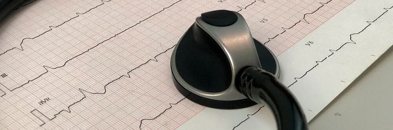Maschinen-EKG: Sensorik und KI sollen dabei helfen, den Zustand einer Komponente und damit ihre Restlebensdauer realistisch abzuschätzen.