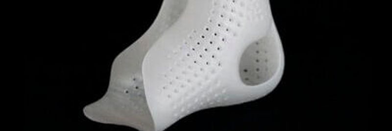 Orthesen aus dem 3D-Drucker können in der Regel besser an die Bedürfnisse der Patienten angepasst werden.