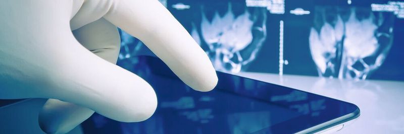 Digitales Röntgen ermöglicht die einfache Verarbeitung sowie sofortige Verfügbarkeit der Aufnahmen und reduziert die Strahlenbelastung der Patienten. Eine neue Technologie soll jetzt die Qualität der Bilder effizient und kostengünstig verbessern.