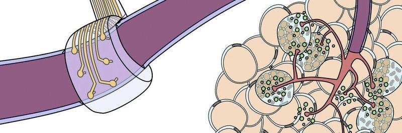Flexible Elektrode in Verbindung mit einem Nervenstrang