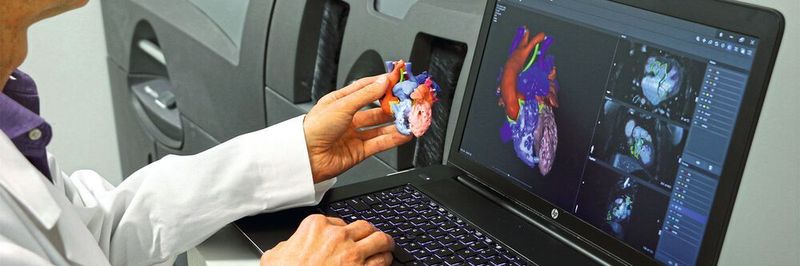 Mit additiv gefertigten Modellen können Mediziner die Operation besser planen und die Patienten anschaulich beraten. Hierfür wird eine organische 3D-Konstruktionssoftware eingesetzt.