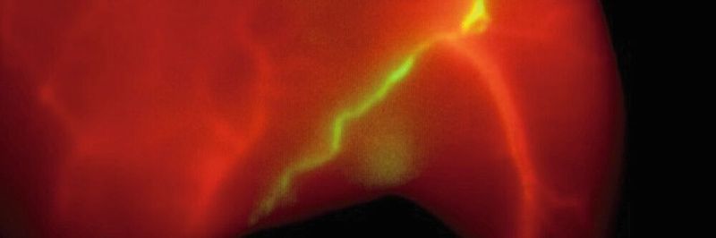 Mit der SWIR-Bildgebung lassen sich in Echtzeit und in Farben Gefäße (rot) und Lymphbahnen (grün) darstellen.
