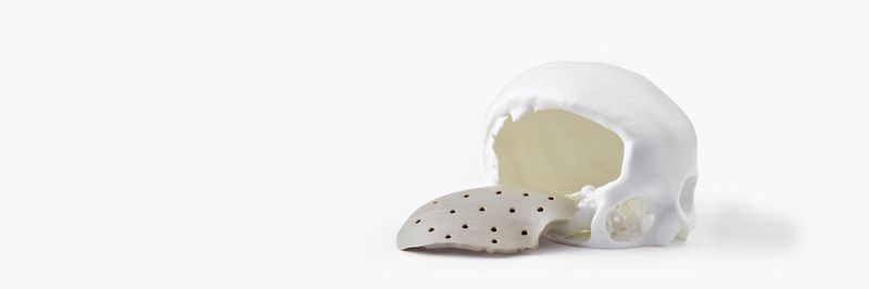 In der Corona-Krise wurden viele medizinische Hilfsmittel mit 3D-Druck hergestellt. Doch Vincent Gardès geht davon aus, dass wir uns erst am Anfang der personalisierten Medizin befinden.