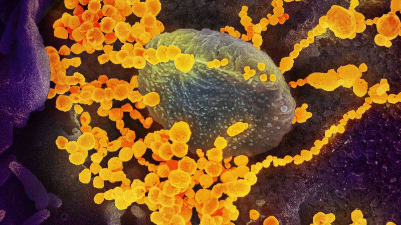 SARS-CoV-2-Viren (runde Goldobjekte) unter dem Rasterelektronenmikroskop. Durch die saure Umgebung auf der Polymeroberfläche werden sie inaktiviert.