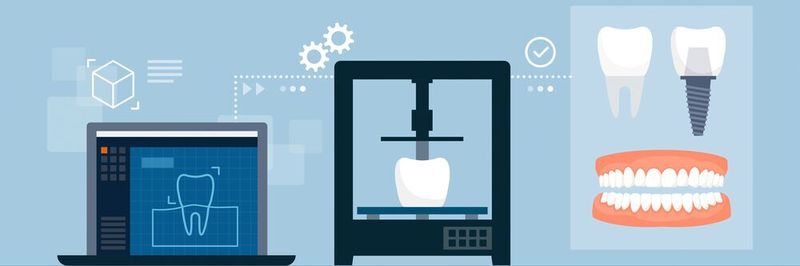 Der 3D-Druck bietet besonders im Bereich der Fertigung von individualisierten Medizinprodukten, wie Dentalimplantaten, großes Potenzial.