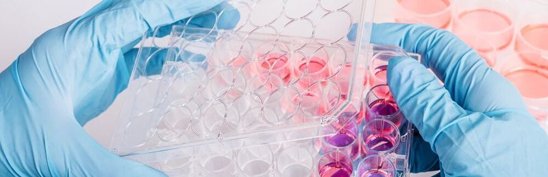 Abb. 1 Die Life-Sciences-Branche ist sehr ressourcenintensiv...