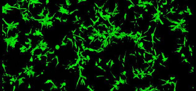 Das Gelatine-basierte Hydrogel X Hydrobio INX U200 wurde speziell für die Einkapselung von verschiedenen Zelltypen entwickelt und erlaubt daher die Erzeugung von komplexen 3D-Mikrogeweben. Es ist z.B. für Anwendungen mit aus Fettgewebe kommenden Stammzellen geeignet.