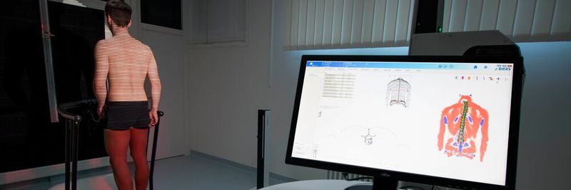 Mit der Technik kann die Wirbelsäule besser analysiert werden