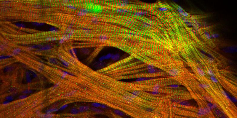 Forschende des Max-Delbrück-Centrum für Molekulare Medizin in der Helmholtz-Gemeinschaft (MDC) haben eine bisher unbekannte Ursache für die Herzhypertrophie gefunden. Sie gilt als die häufigste Ursache für den plötzlichen Herztod.