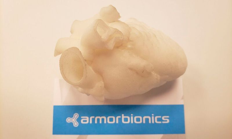 Additiv gefertigte Modelle wie dieses 3D-Herz können dazu beitragen, mögliche Komplikationen während einer OP vorherzusehen und damit zu vermeiden.