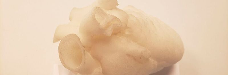 Additiv gefertigte Modelle wie dieses 3D-Herz können dazu beitragen, mögliche Komplikationen während einer OP vorherzusehen und damit zu vermeiden.