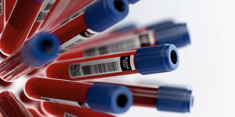 Bluttests werden für das Routine-Screening und die frühzeitige Erkennung einer Vielzahl an Erkrankungen eingesetzt.
