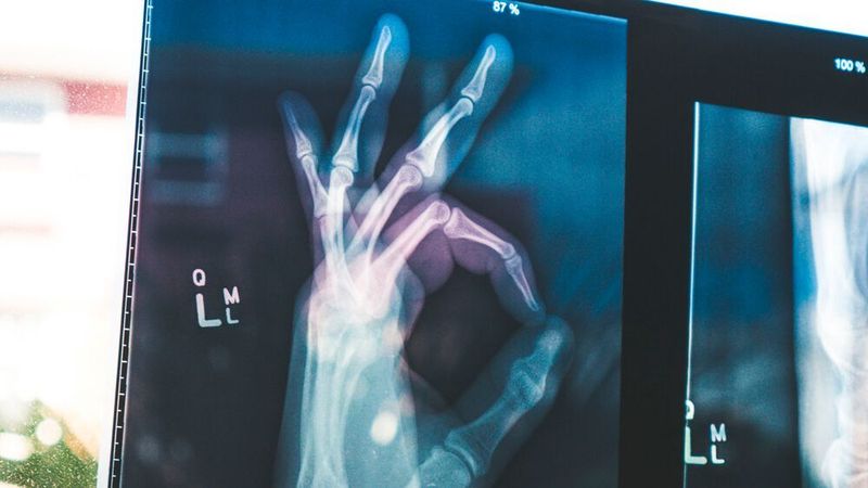 Per 5G sollen beispielsweise MRT- und Röntgenaufnahmen Klinikweit schnell verfügbar sein.