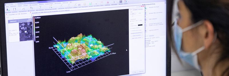 Morphologische Charakterisierung des Festkörperelektrolyts und der Komposit-Kathode.