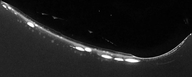 Fluoreszenzmikroskopische Aufnahme von Protozellen in Kontakt mit einer Gasblase. Koazervat-Ansammlungen sind ein geeignetes Modell, um die ersten Protozellen auf der frühen Erde nachzuahmen und zu untersuchen, wie sich Leben entwickelt haben könnte.