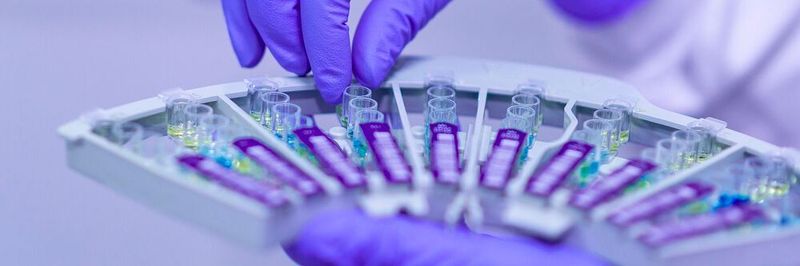 Das Seminar zur neuen europäischen Verordnung über In-vitro-Diagnostika von Devicemed gibt einen systematischen Überblick zum neuen Rechtsrahmen. (Symbolbild)