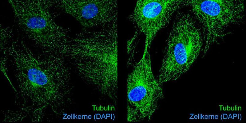 Immunfluoreszenzaufnahmen von Tubulin (grün) und Zellkernen (blau) in unbehandelten (links) und Glyoxal-behandelten Endothelzellen (rechts). Die Glykierung von Tubulin durch Glyoxal führt zu veränderter Mikrotubuli-Dynamik und Hemmung der Zellteilung.