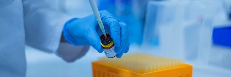 Wie ist der aktuelle Stand der IVDR-Umsetzung in den Unternehmen? Das wollten Climedo und Triga-S Scientific Solutions in einer gemeinsamen Umfrage wissen. (Symbolbild)