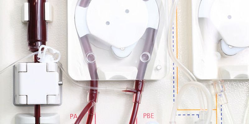 Dialysegeräte: In medizinischen Apparaturen für die Blutwäsche sorgen integrierte Ultraschallsensoren für gleichmäßigen und luftblasenfreien Flüssigkeitstransport.