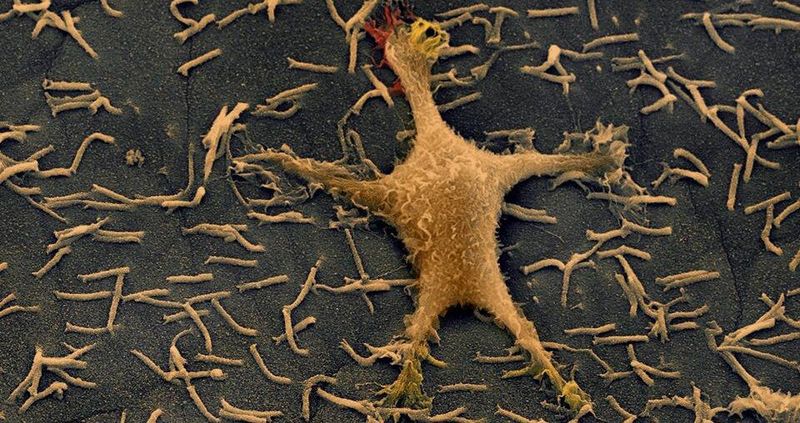 Siegerfoto des bundesweiten Fotowettbewerbs "Nano-Momente: „Wenn Hennen rennen“ (Kolorierte rasterelektronenmikroskopische Aufnahme)