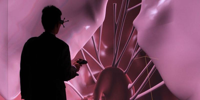 Das Living Heart-Modell wurde auf der 3D-Experience-Plattform von Dassault Systèmes entwickelt. Es umfasst wohldefinierte anatomische Details des Herzens sowie des proximalen Gefäßsystems, wie beispielsweise Aortenbogen, Lungenarterien und obere Hohlvene.