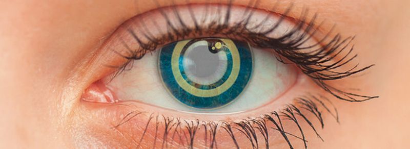 Nach einer minimal-invasiven Implantation überwacht der Mikrosensor kontinuierlich den Augeninnendruck bei Grünem-Star-Erkrankungen.
