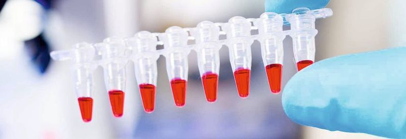 Abb. 1: Die PCR vervielfältigt auch kleinste Mengen DNA durch wiederholte Verdopplung in mehreren Zyklen mithilfe des Enzyms DNA-Polymerase.