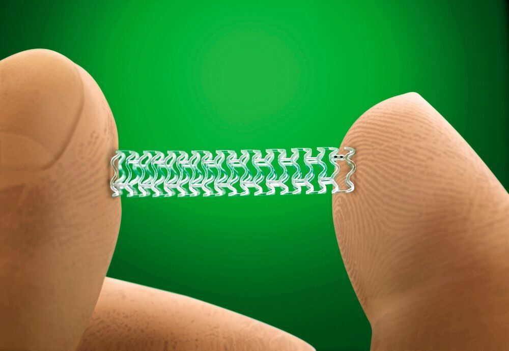 Was Ist Ein Stent Operation Risiken Und Herstellung