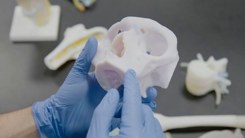 Die anatomischen 3D-Druckmodelle ermöglichen es Ärzten, komplexe Operationen zu planen und durchzuführen und die Kommunikation zwischen medizinischem Personal, dem Patienten und seinen Familien zu verbessern..