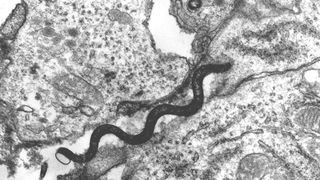 Elektronenmikroskop-Aufnahme eines Treponema-Bakteriums zwischen zwei Wirtszellen. (Steven J. Norris, UTHealth McGovern Medical School, Houston/USA)