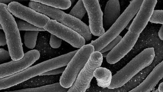 E. coli ist eine der viele Bakterienarten, die den Darm besiedeln. (Bild: © Rocky Mountain Laboratories, NIAID, NIH [Public domain], via Wikimedia Commons)