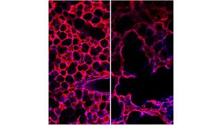 Helmholtz-Forscher haben einen Mechanismus aufgedeckt, der erklärt wie gesundes Lungengewebe (links) langfristig seine Struktur verliert (rechts). Quelle: (Helmholtz Zentrum München)